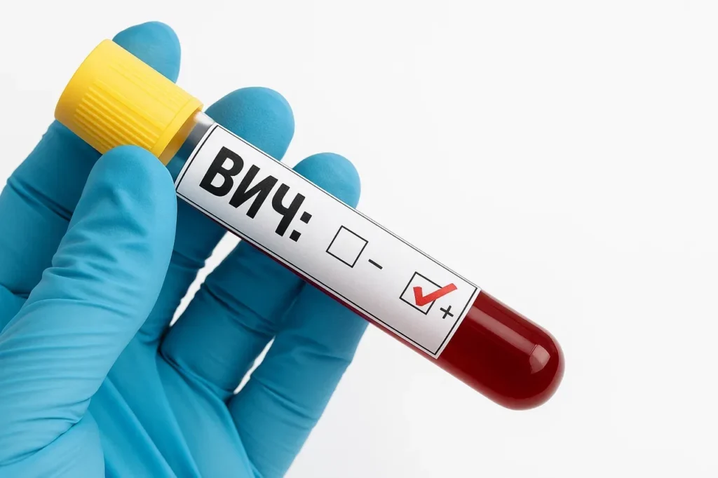 Қай өңірде ВИЧ жұқтырғандар көп тіркелді?